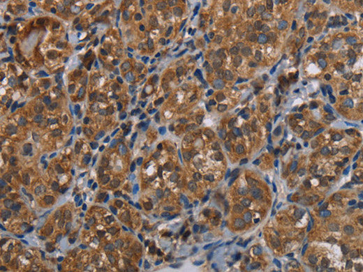 LLGL1 Polyclonal Antibody Store at -20°C
