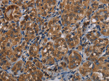 LLGL1 Polyclonal Antibody Store at -20°C