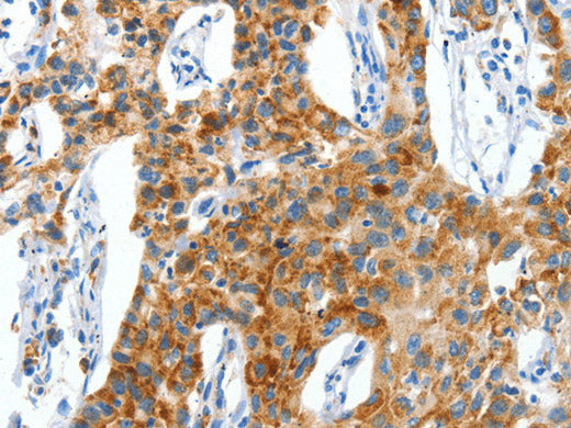 CKAP4 Polyclonal Antibody Store at -20°C