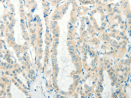 RAB25 Polyclonal Antibody Store at -20°C