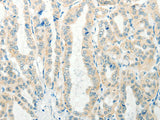 RAB25 Polyclonal Antibody Store at -20°C