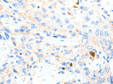 P2RY1 Polyclonal Antibody