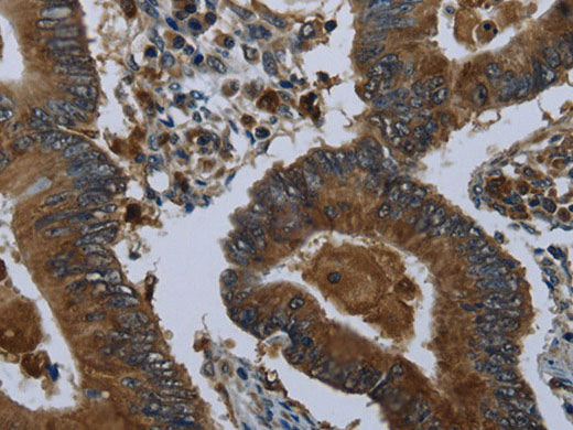 GLUL Polyclonal Antibody Store at -20°C