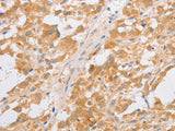 CDKN2AIP Polyclonal Antibody Store at -20°C
