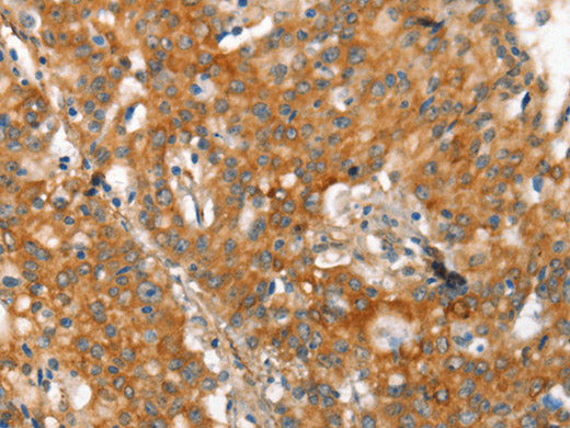 MMP2 Polyclonal Antibody Store at -20°C