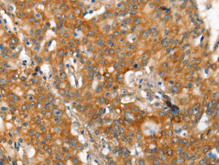 MMP2 Polyclonal Antibody Store at -20°C