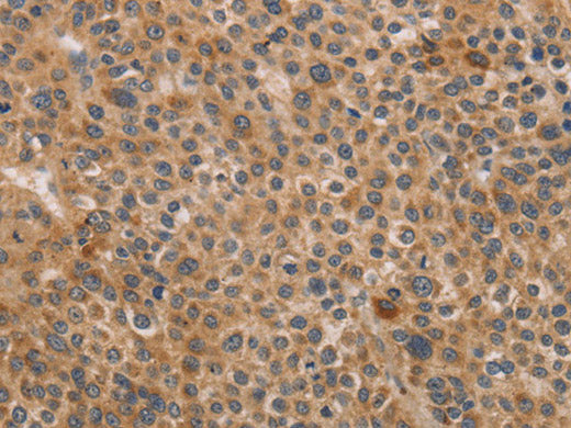 CDK11B Polyclonal Antibody Store at -20°C