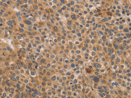 CDK11B Polyclonal Antibody Store at -20°C