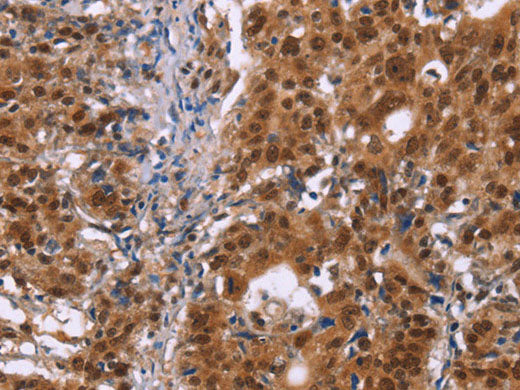 CBX3 Polyclonal Antibody
