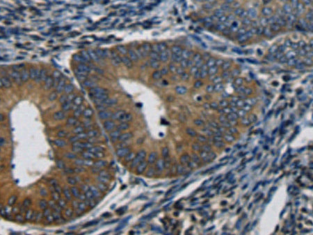 CTGF Polyclonal Antibody Store at -20°C