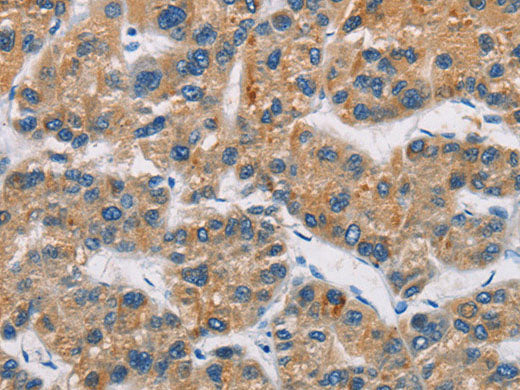 CERK Polyclonal Antibody Store at -20°C