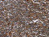 MAGEA3 Polyclonal Antibody