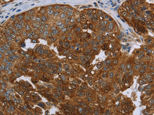 SNCG Polyclonal Antibody Store at -20°C