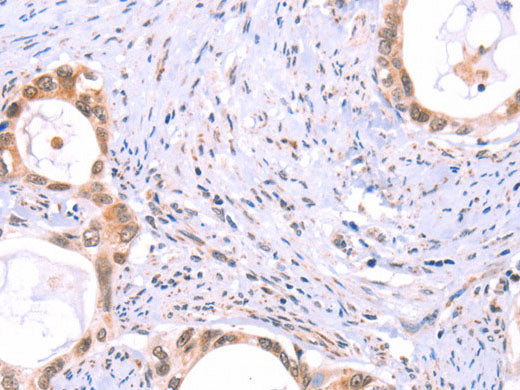 PROS1 Polyclonal Antibody Store at -20°C