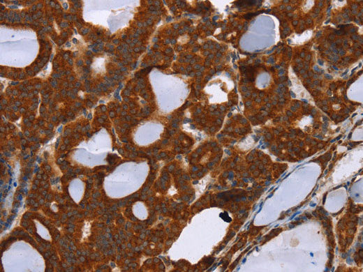 PPP2R3C Polyclonal Antibody Store at -20°C