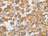 ARHGAP15 Polyclonal Antibody Store at -20°C