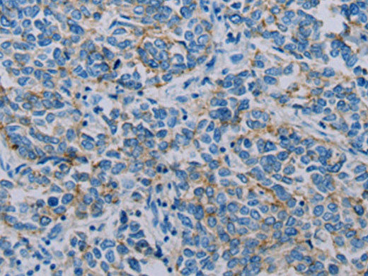 Claudin 4 Polyclonal Antibody Store at -20°C