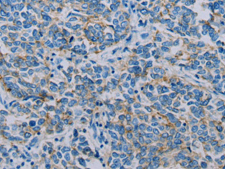Claudin 4 Polyclonal Antibody Store at -20°C