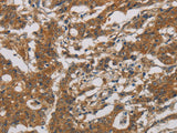 CNDP1 Polyclonal Antibody Store at -20°C