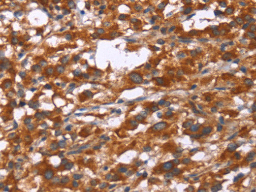 Gphn Polyclonal Antibody Store at -20°C