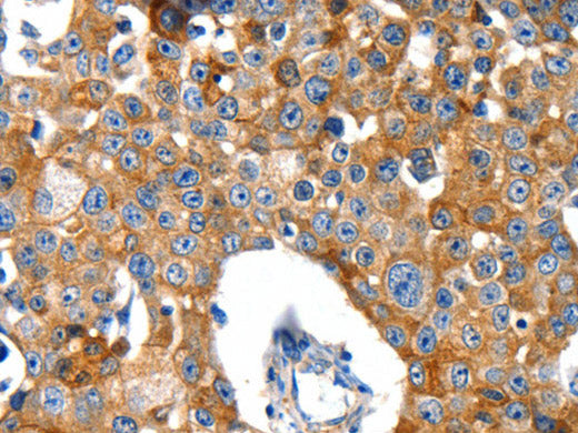 GluR2 Polyclonal Antibody Store at -20°C