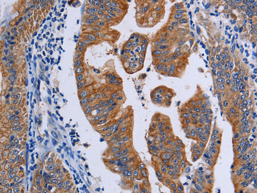 ACP6 Polyclonal Antibody Store at -20°C
