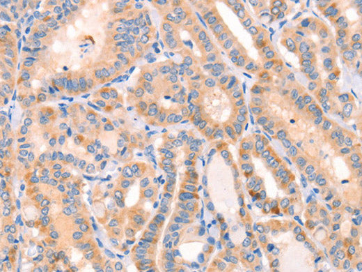 CD109 Polyclonal Antibody