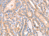 CD109 Polyclonal Antibody