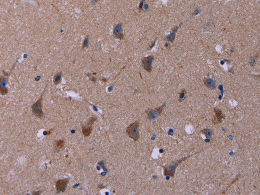 TUBGCP2 Polyclonal Antibody Store at -20°C