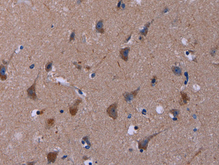 TUBGCP2 Polyclonal Antibody Store at -20°C