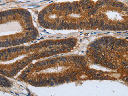 PDCD7 Polyclonal Antibody Store at -20°C