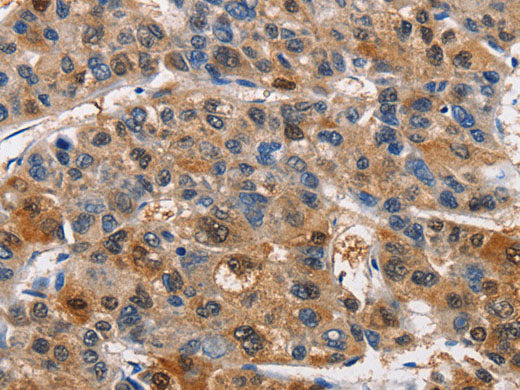 PIM1 Polyclonal Antibody Store at -20°C