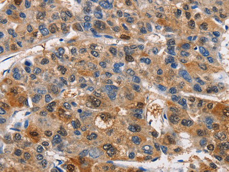 PIM1 Polyclonal Antibody Store at -20°C