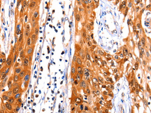 FBLN1 Polyclonal Antibody Store at -20°C