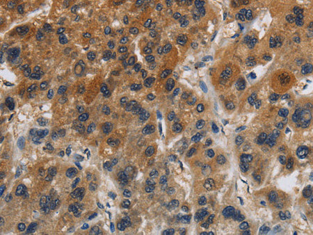 Claudin 8 Polyclonal Antibody Store at -20°C