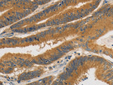 PRKD1 Polyclonal Antibody Host Rabbit