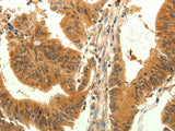TRPM7 Polyclonal Antibody Store at -20°C