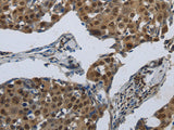 PRKAR1B Polyclonal Antibody Store at -20°C