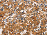 CDC25B Polyclonal Antibody Store at -20°C