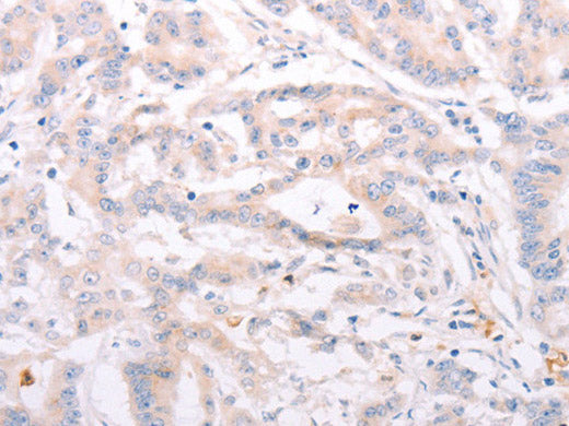 ANKRA2 Polyclonal Antibody