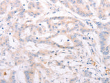 ANKRA2 Polyclonal Antibody