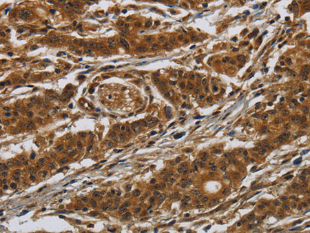 GATA5 Polyclonal Antibody Store at -20°C