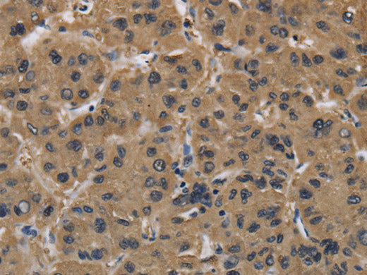 FABP2 Polyclonal Antibody Store at -20°C