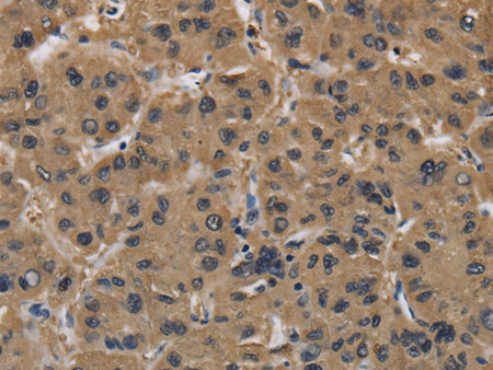 FABP2 Polyclonal Antibody Store at -20°C