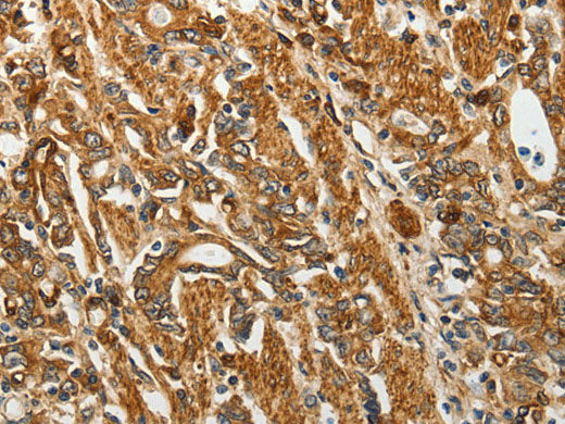RPLP0 Polyclonal Antibody Reactivity Human, Mouse, Rat