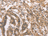 PEBP1 Polyclonal Antibody Store at -20°C