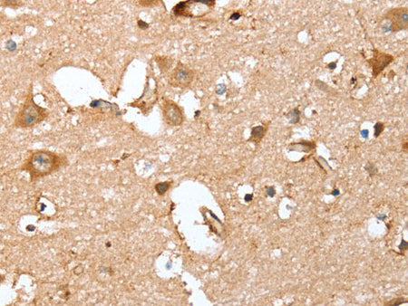 CAPG Polyclonal Antibody Store at -20°C