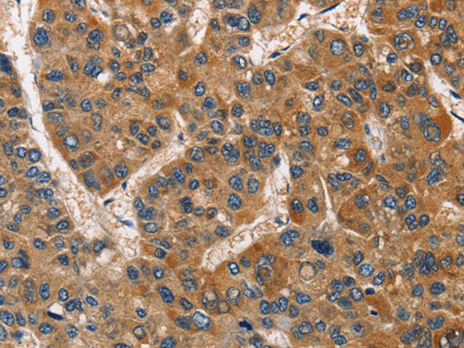 BABAM2 Polyclonal Antibody Store at -20°C