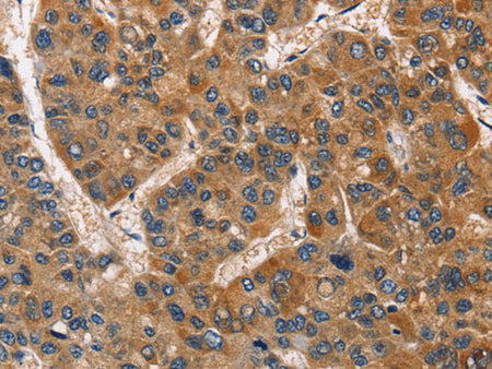BABAM2 Polyclonal Antibody Store at -20°C