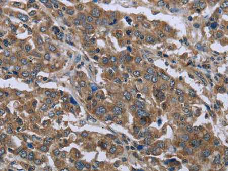 GGCX Polyclonal Antibody Store at -20°C